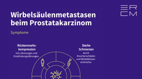 Forschung Publikationen Wirbelsäulenmetastasen